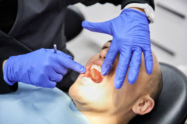 Best Emergency Dentist for Lost Fillings or Crowns in Highland, IN